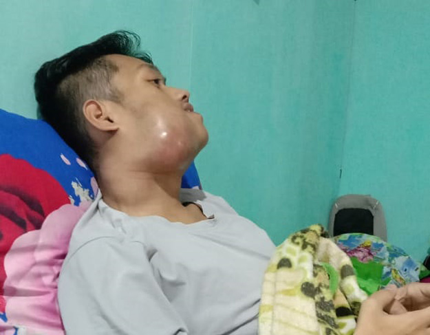 Terbaring Sakit, Juara MTQ dari Jembayan Ini Butuh Uluran Tangan